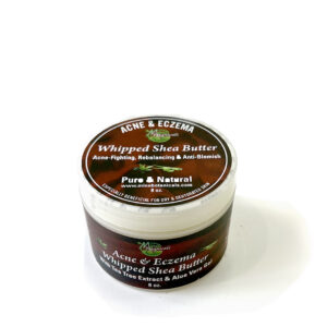 Acne & Azcema Whipped Shear Butter_8oz